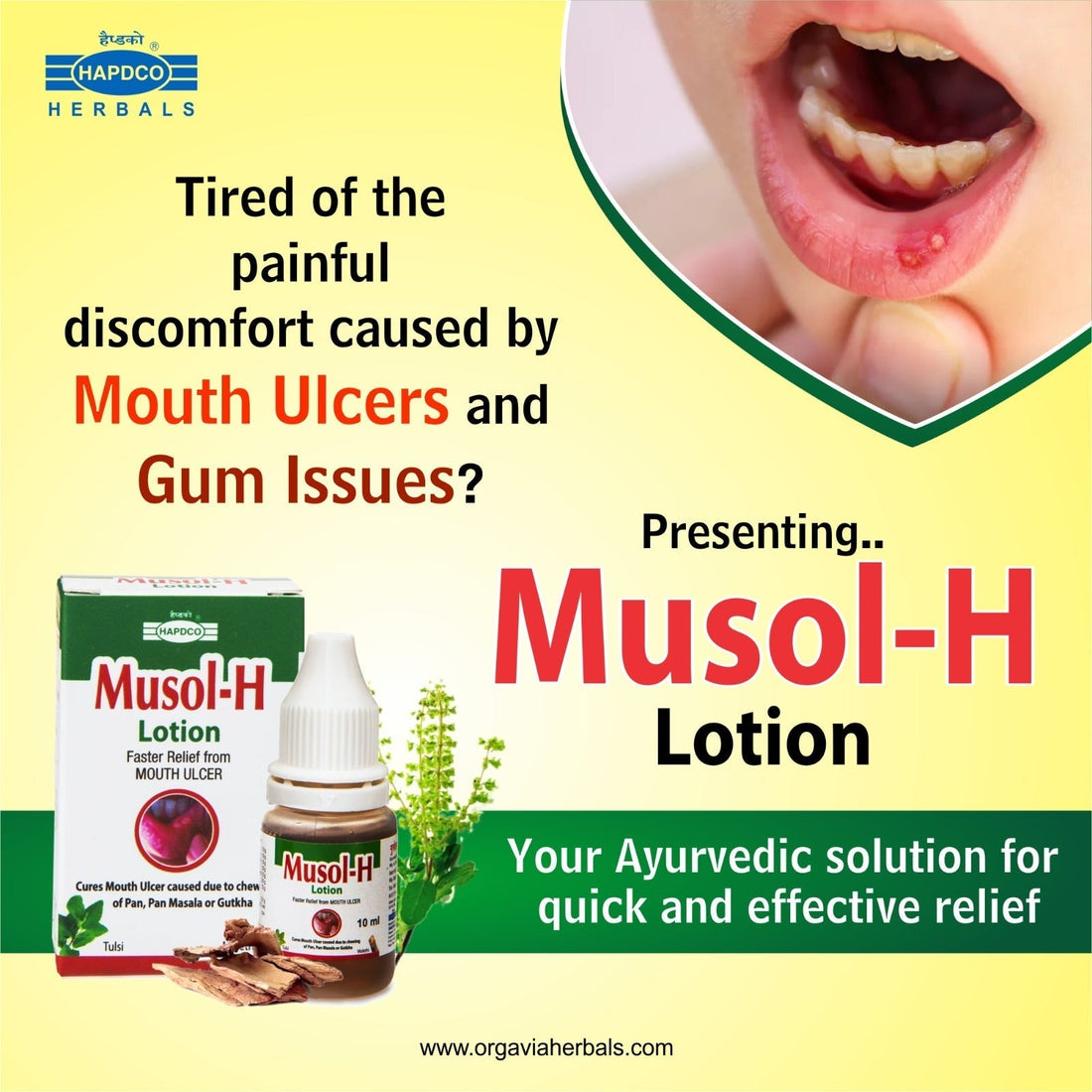 Why Musol-H Lotion Is Useful for Mouth Ulcers & Oral Discomfort ...